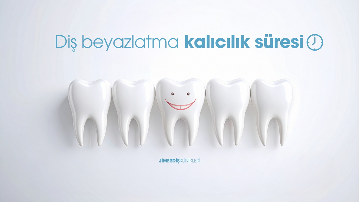 Teeth Whitening Retention Time Teeth Whitening Retention Time